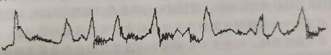 電子產品抗震緩衝性（xìng）能檢測方法與技術簡介